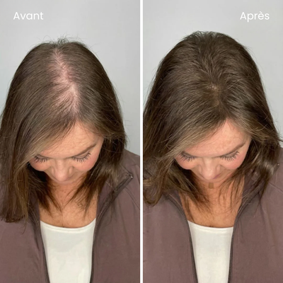 éline™ - Shampoing Anti-Chute