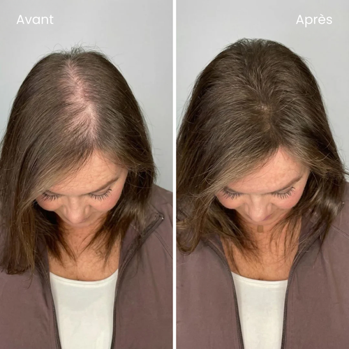 éline™ - Shampoing Anti-Chute