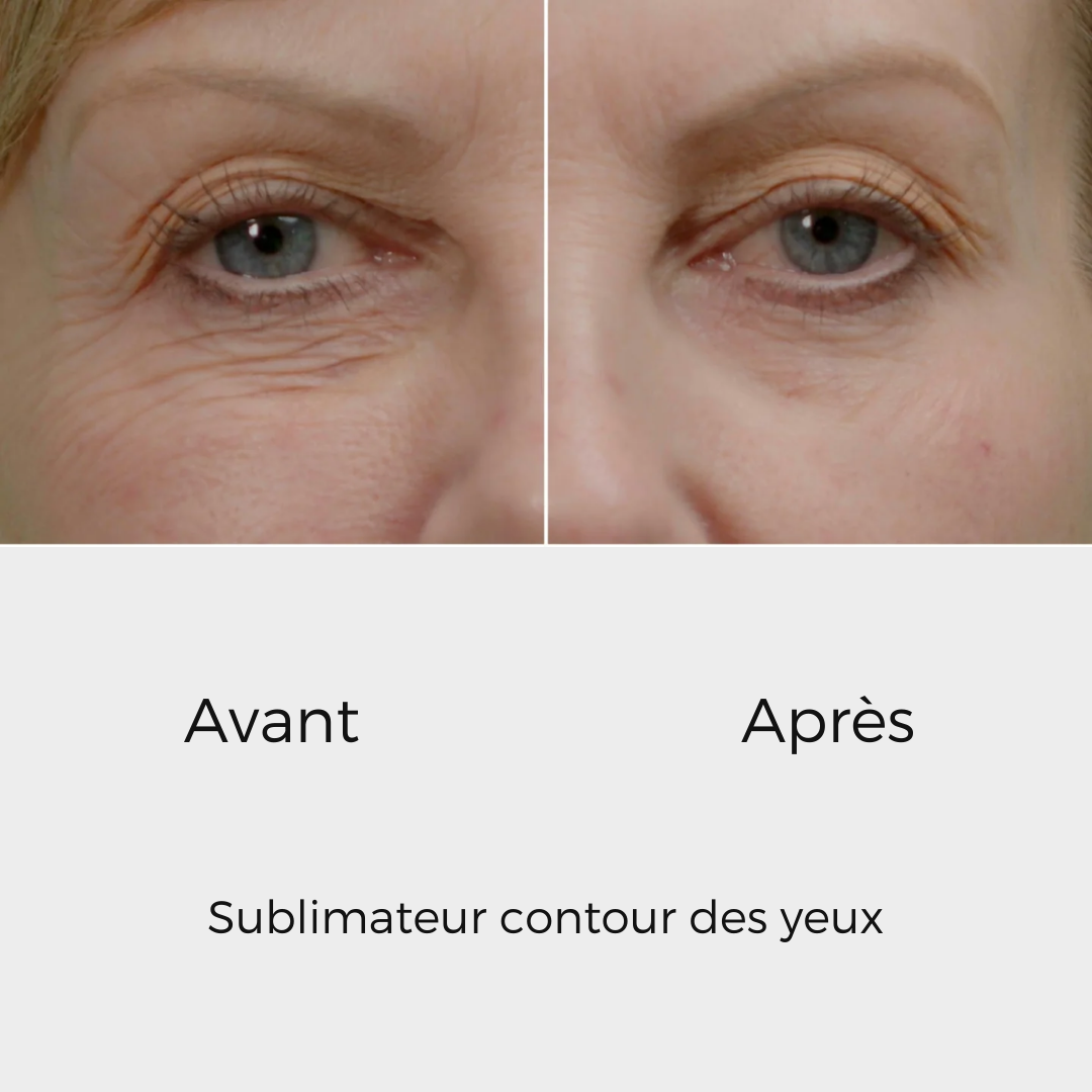 éline™ - Sublimateur Conteur Yeux