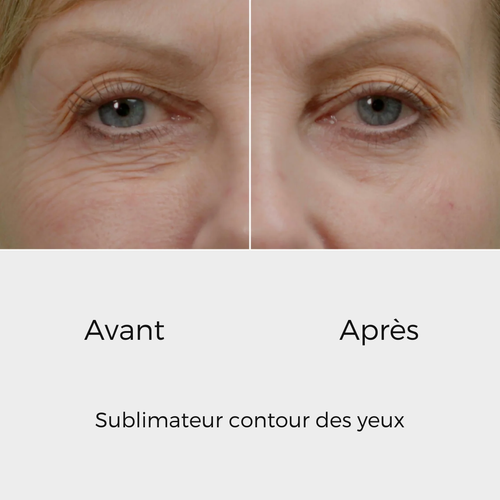 éline™ - Sublimateur Conteur Yeux