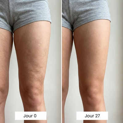 éline™ - Huile de Massage Anti-Cellulite