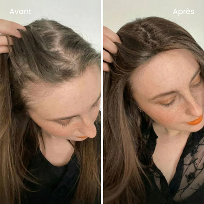 éline™ - Shampoing Anti-Chute