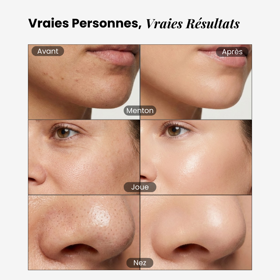 éline™ - Serum Exfoliant