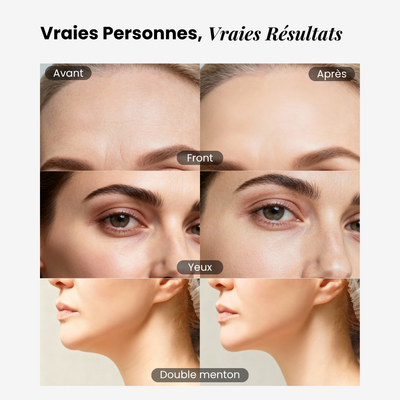 Brosse lymphatique pour le visage éline™