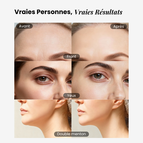 Brosse lymphatique pour le visage éline™