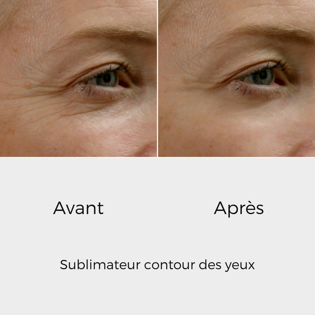 éline™ - Sublimateur Conteur Yeux