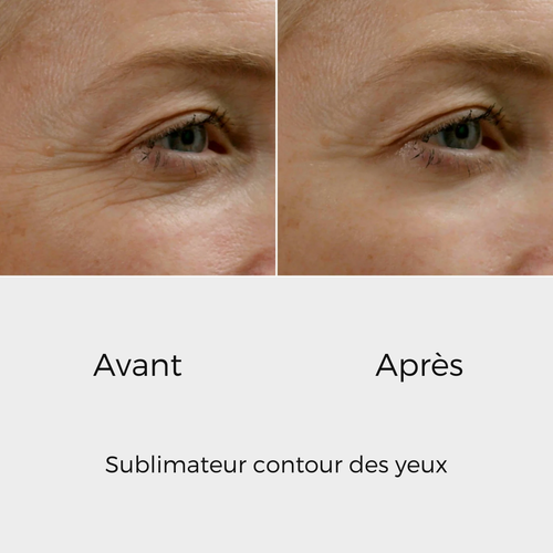 éline™ - Sublimateur Conteur Yeux