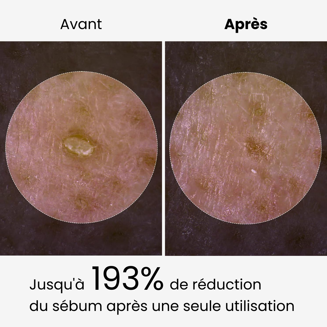 éline™ - Serum Exfoliant