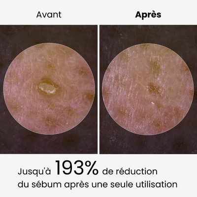éline™ - Serum Exfoliant