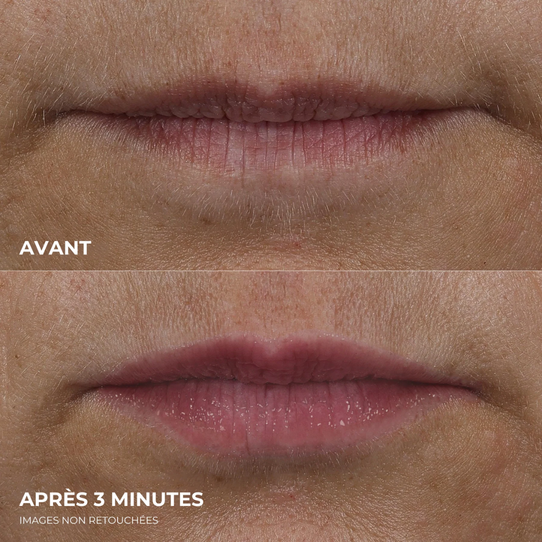 éline™ - Repulpeur de Lèvres