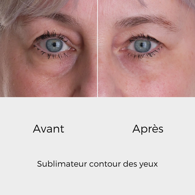 éline™ - Sublimateur Conteur Yeux