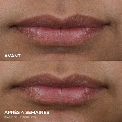 éline™ - Repulpeur de Lèvres