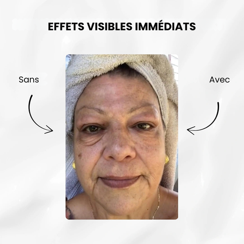 éline™ - Soin Anti-Poches