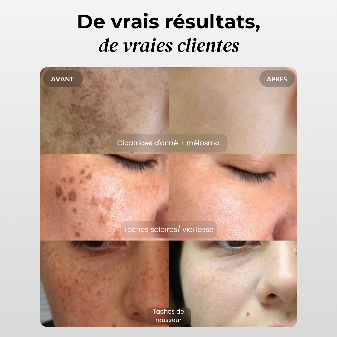 Correcteur de Tâche Brune